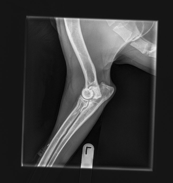 X-Ray of Elbow
